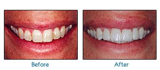 Before and after dental patient pictures