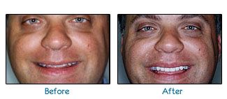 Before and after dental patient pictures