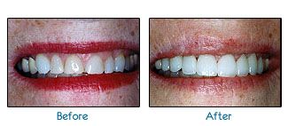 Before and after dental patient pictures