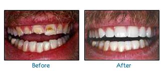 Before and after dental patient pictures